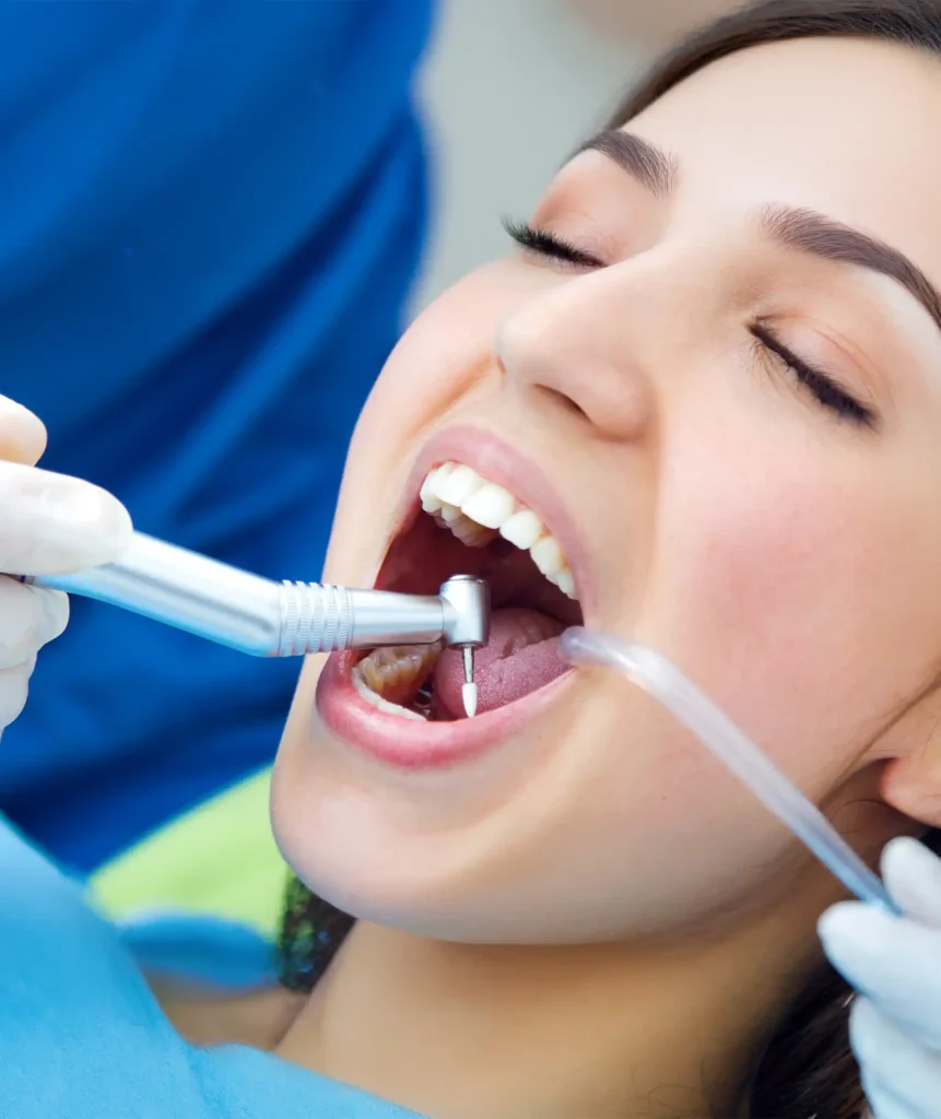 Dentist treating a cavity in a patient's tooth following early caries detection