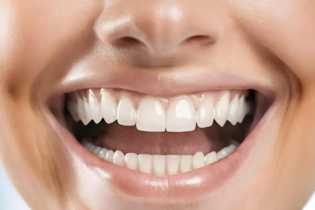 What is Preventive & General Dentistry_